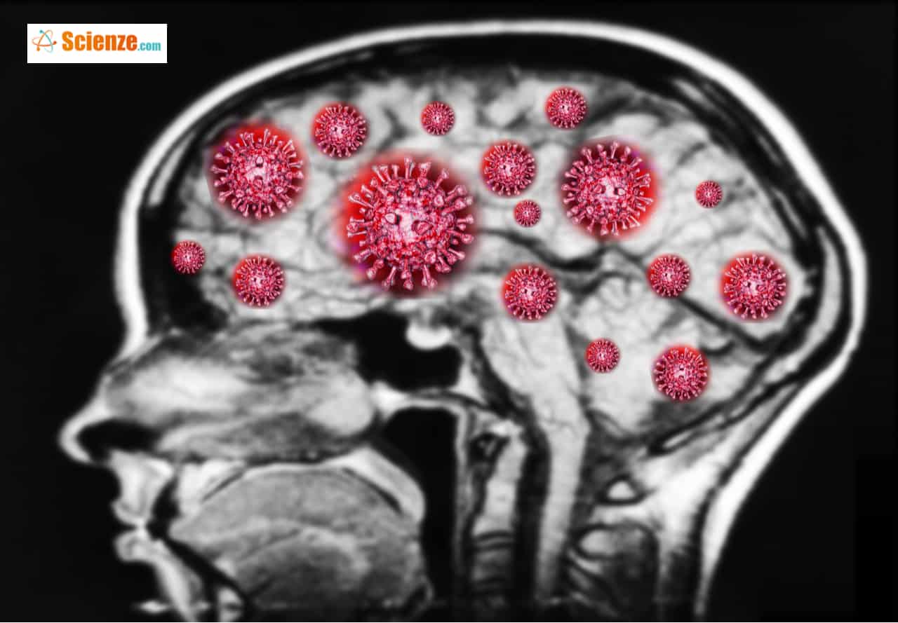 Gli effetti del Covid-19 a livello cerebrale