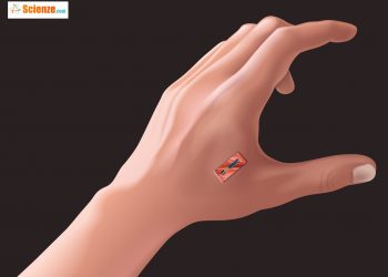 Esempio di microchip impiantato sulla mano