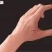 Esempio di microchip impiantato sulla mano